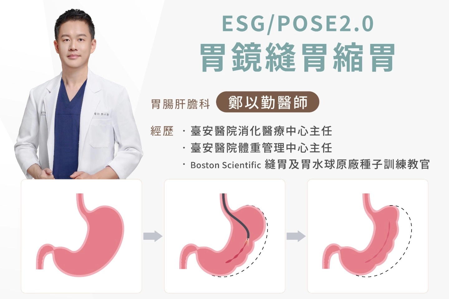 這是一張説明圖：台中誠美學診所ESG胃鏡縫胃由鄭以勤醫師主理，鄭以勤醫師曾經是臺安醫院消化醫療中心主任；現任Boston Scientific縫胃及胃水球原廠種子訓練教官