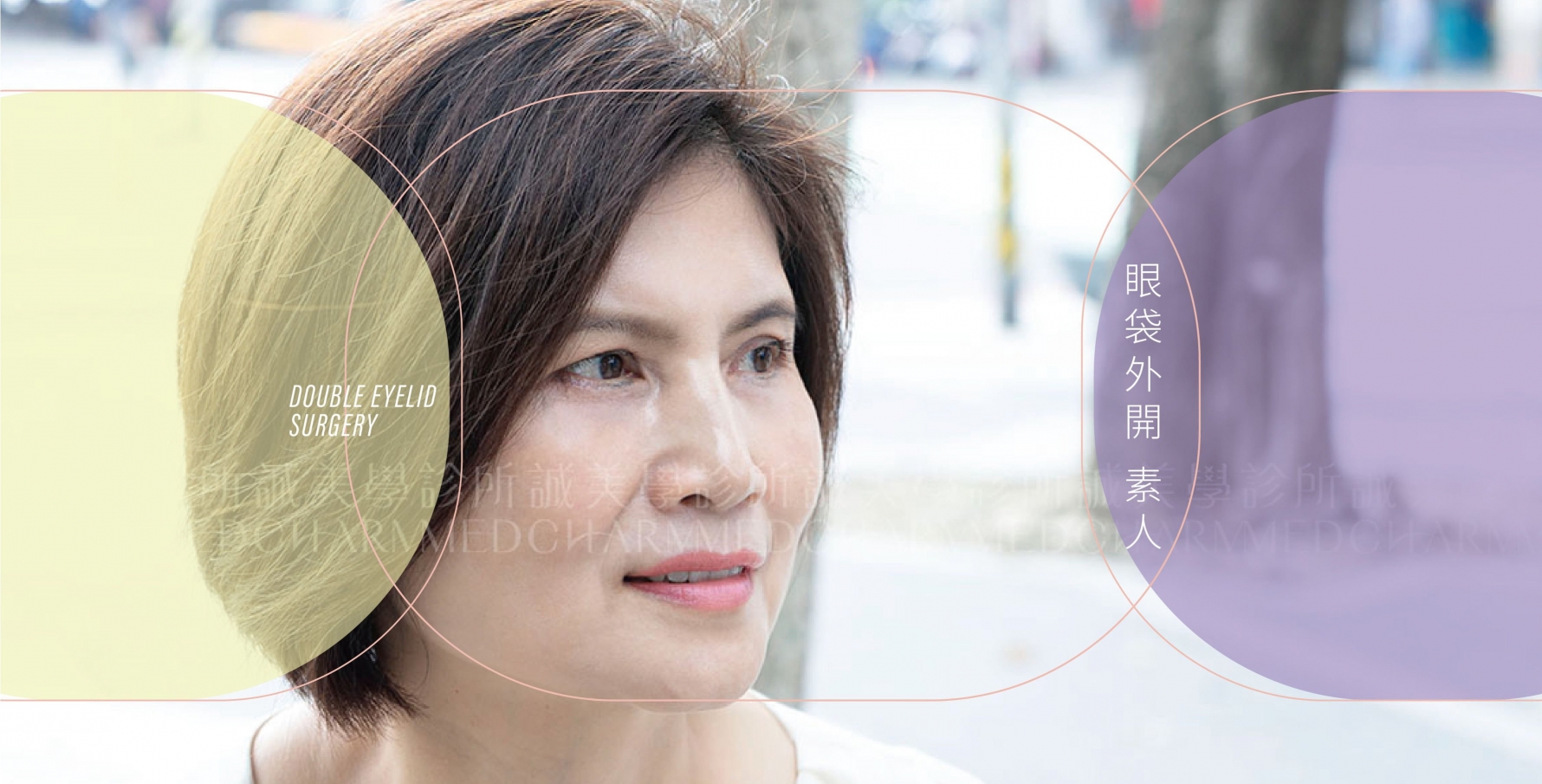 眼袋外開素人