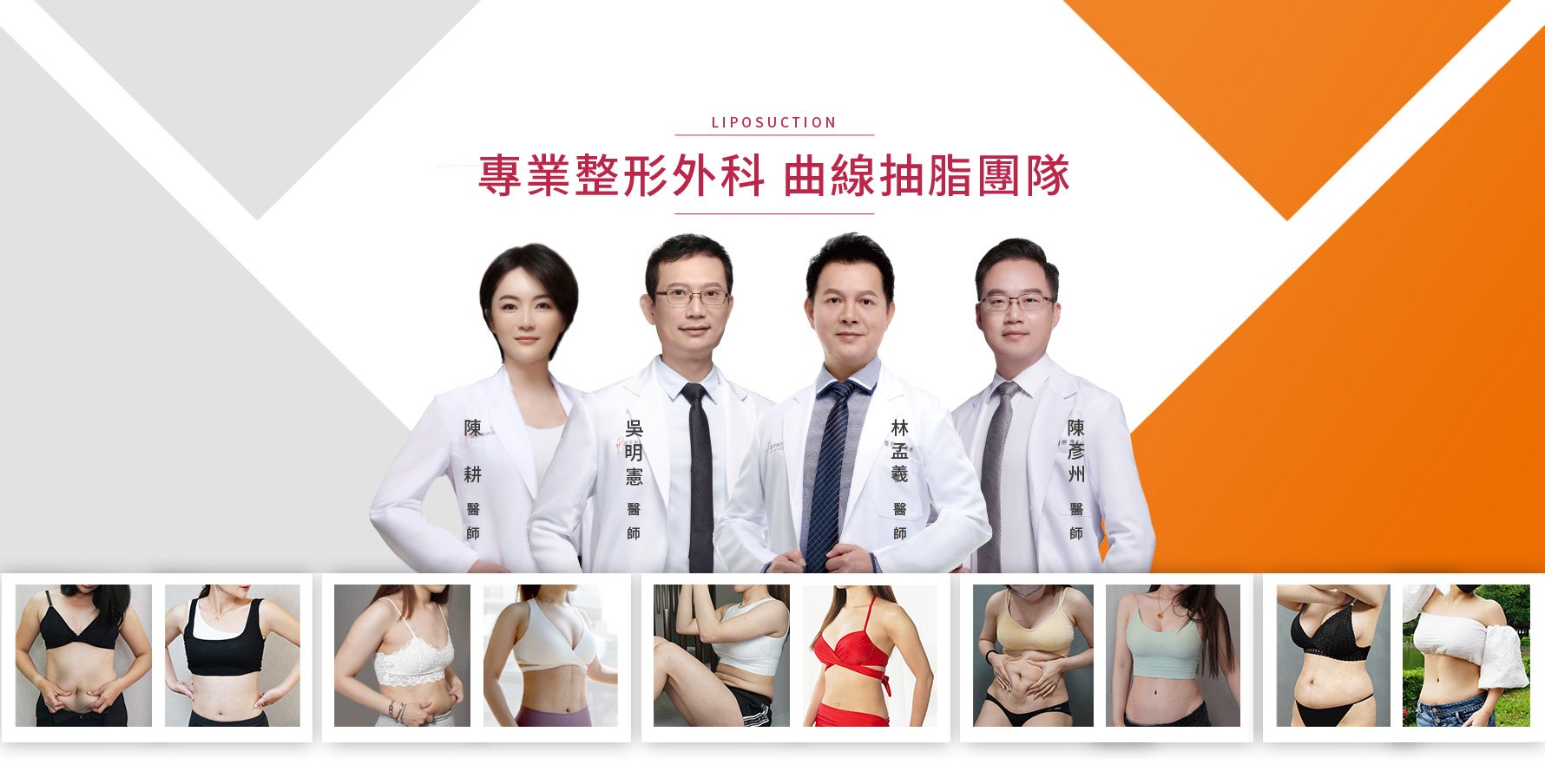 台中抽脂｜二代威塑｜二代水刀｜林孟羲醫師｜吳明憲醫師｜陳彥州醫師｜陳耕醫師