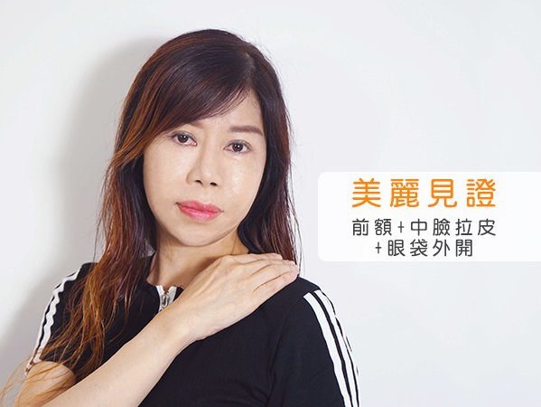 台中臉部拉皮+眼袋外開｜林孟羲院長｜誠美學診所