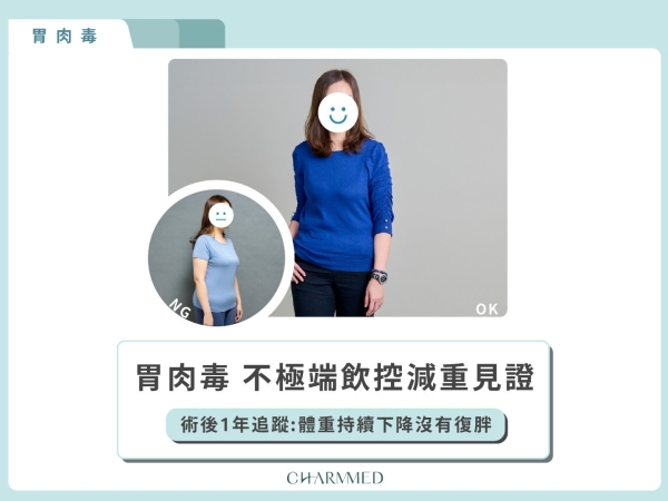 減重案例分享：不挨餓！術後一年追蹤持續塑身 | 誠美學診所 鄭以勤醫師