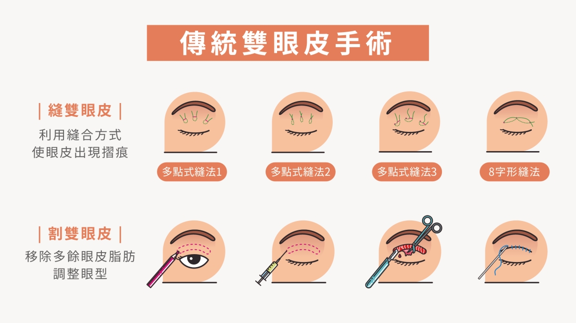 SEO文章設計-雙眼皮_工作區域 1