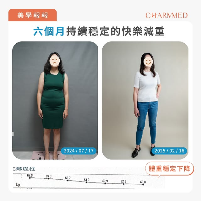 胃肉毒案例見證-1