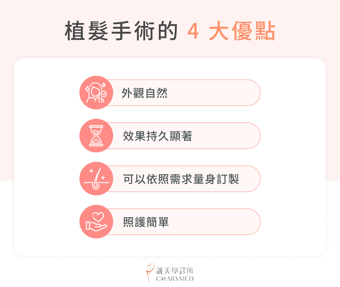 植髮手術的 4 大優點