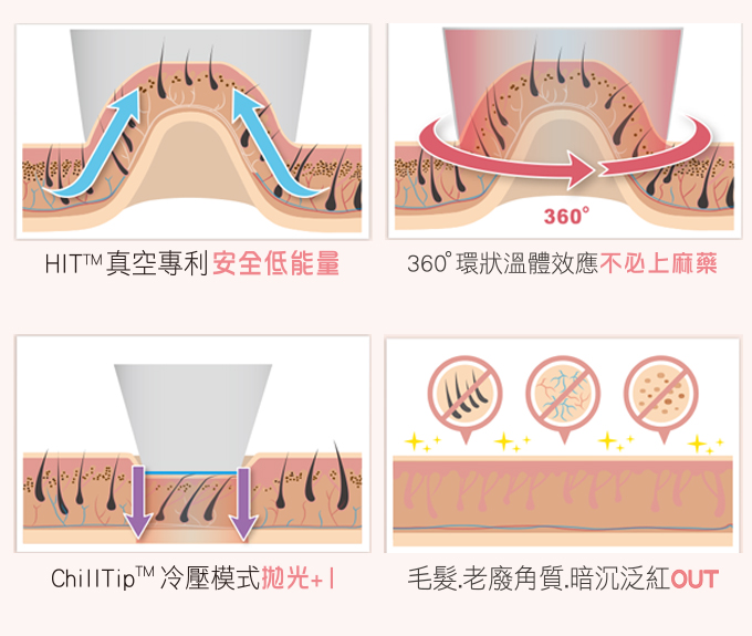 Lightsheer 真空除毛