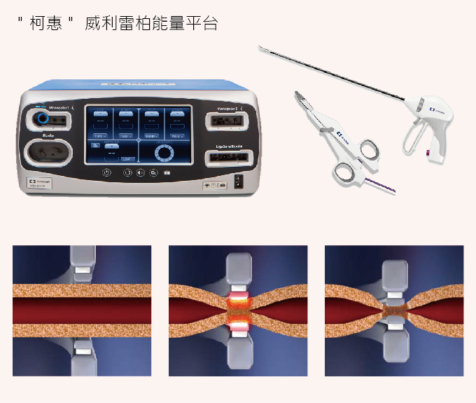 LigaSure 威利雷柏能量平台