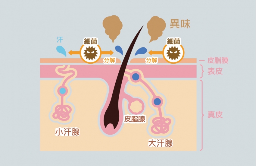 頂漿汗腺切除手術：狐臭手術