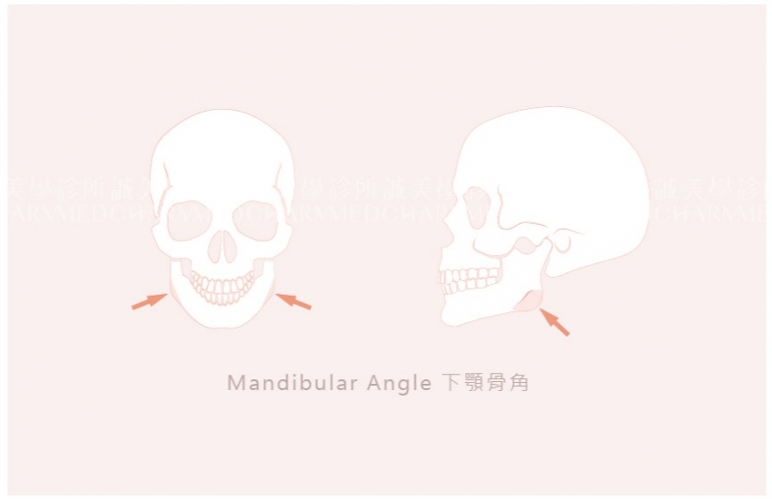 下頷骨削骨