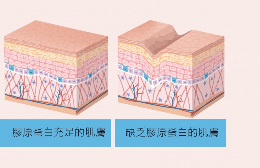 双美膚力原膠原蛋白植入劑