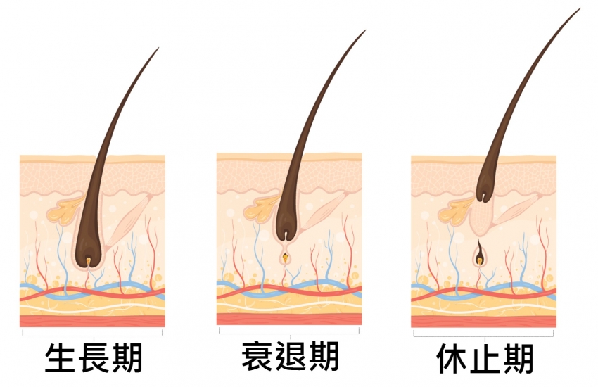 "沃泰克"黑爾蓬雷射生髮帽