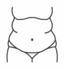 胃鏡減重